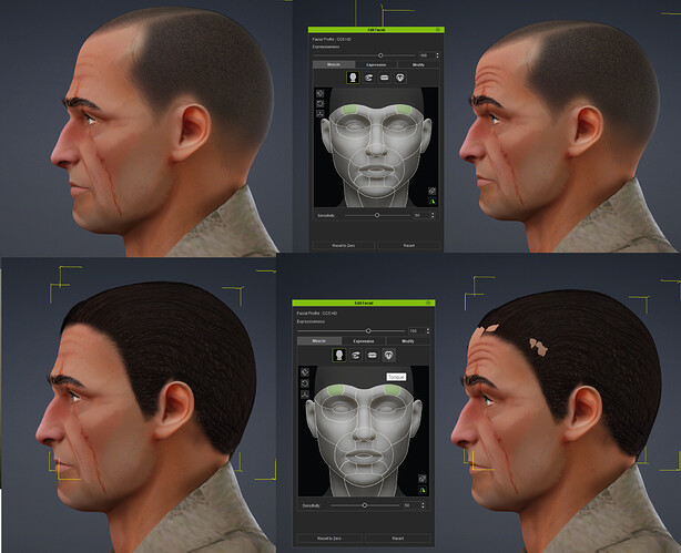 scalp conform issues