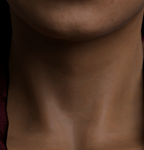 Neck